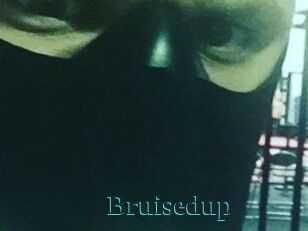 Bruisedup